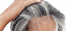 hair restoration treatment