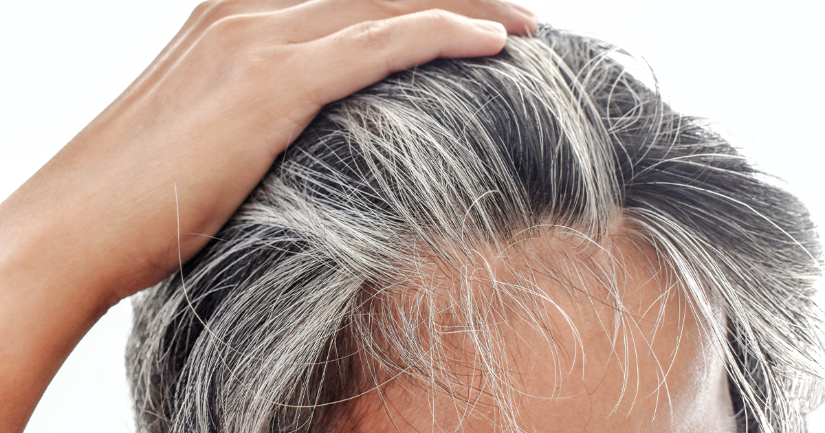 hair restoration treatment