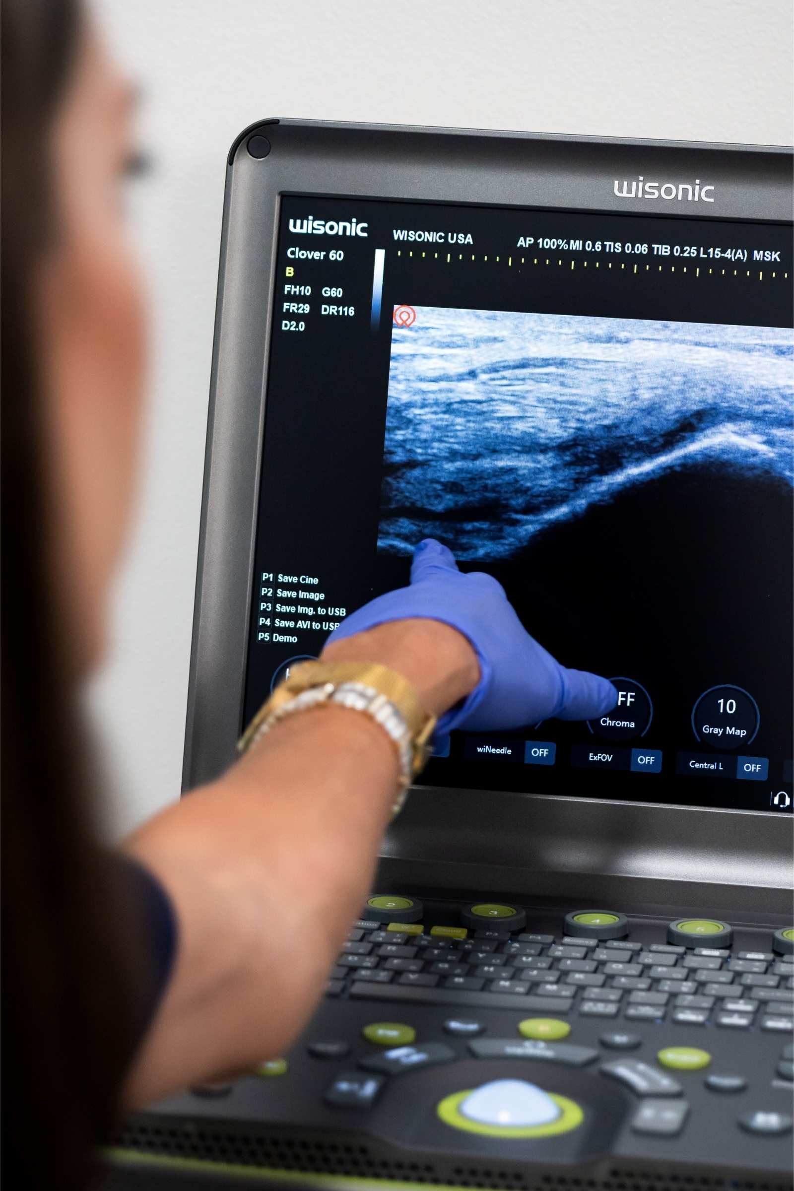 Dr Deol with ultrasound machine