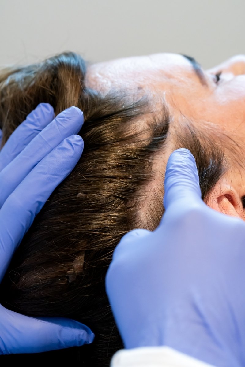 Hair Restoration - healthcare worker tending patients hair